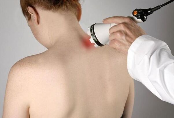 Terapia laser